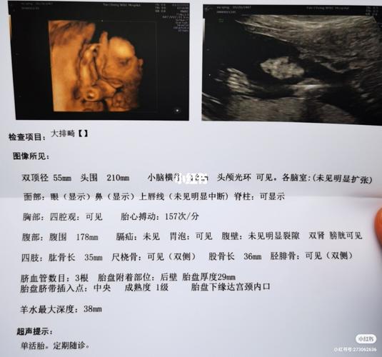 22周四维彩超顺利通过!感恩!