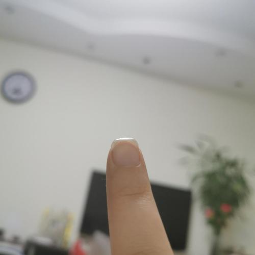 指甲向下抠很严重,是什么问题呢?(图片有更新)