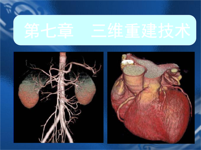 医学成像技术第八章三维重建技术ppt86页
