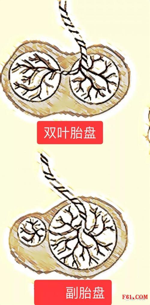 双叶胎盘和副胎盘