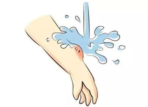 二, 消毒伤口