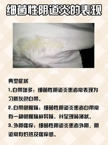 细菌性阴炎被我用它轻松解决了._私处_妇科炎症_炎症