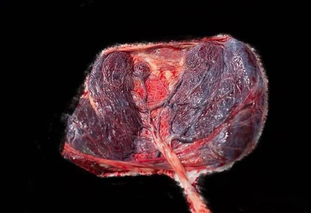 我理解的双叶胎盘_手机搜狐网