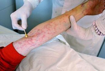 艾滋病患者的剧情梗概