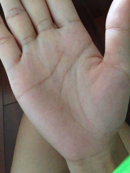 为什么我的手掌这么白,别的女生都是很红的?这是为什么?好不好?