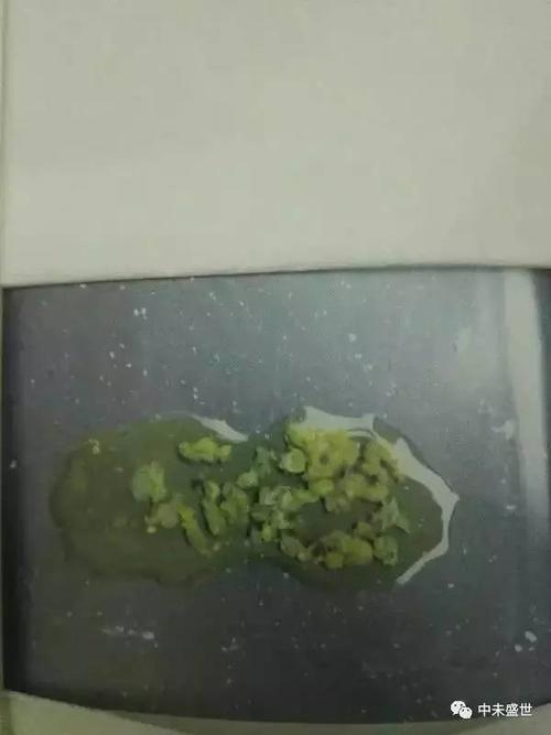 感染4沙门氏菌感染3新城疫病毒感染2正常健康鸽子粪便今天通过整理,把