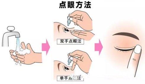 一,眼药水的使用方法