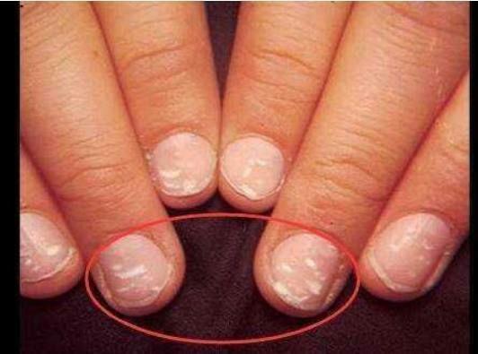 手指甲长这几样东西一定要注意了