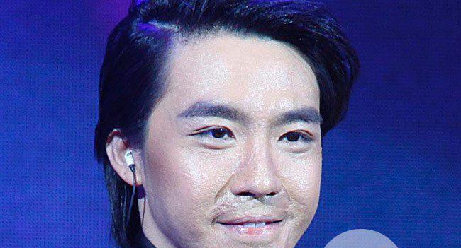 俞灏明烧伤疤痕全照 俞灏明疤痕明显