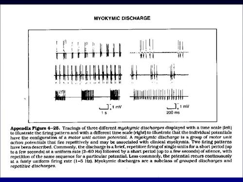 神经肌电图的临床应用ppt
