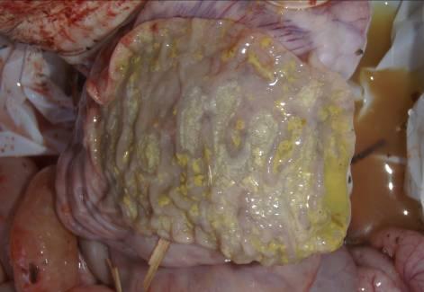 组织学病变包括:淋巴损耗,合胞体形成的肉芽肿性炎症,组织细胞