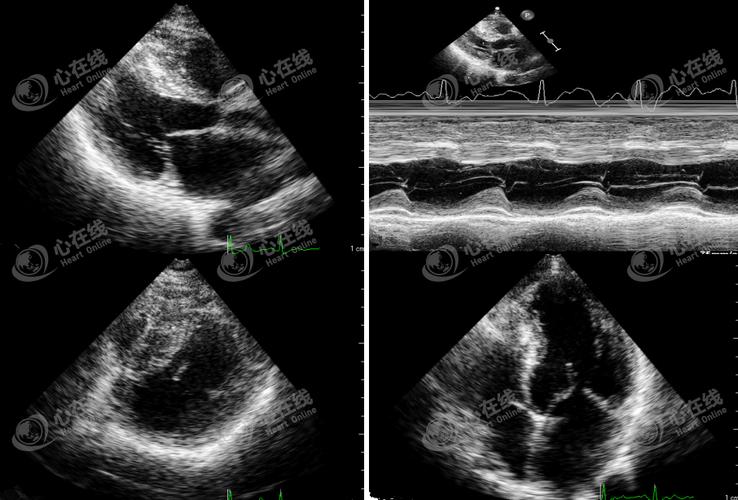 扁柏的功效与作用(原来全身是宝)