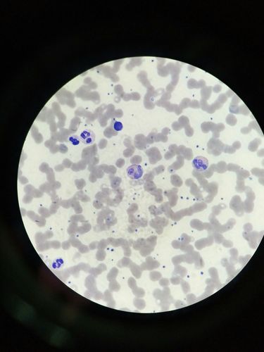 嗜酸嗜碱性粒细胞