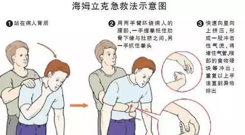 若是无呼吸现象,则施行心肺复苏法.