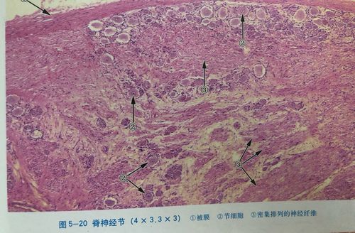 spinal ganglion脊神经节