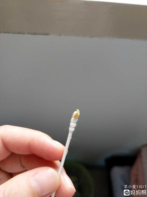 耳朵分泌物