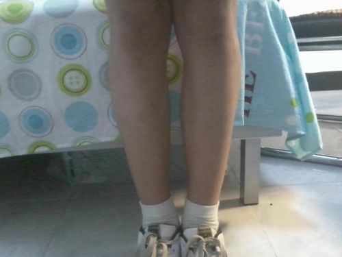 我15岁,上初三,相当一个演员,知道腿型的重要,请大家看一下我的腿,可