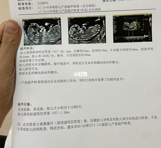 12 6啦,昨天做nt的时候十几分钟做完,宝宝不怎么配合,医生还让我侧着