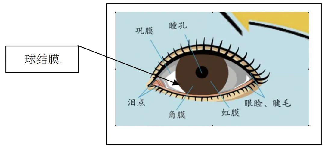 大咖课堂 | 李丽红教授谈"儿童病毒性结膜炎的预防和治疗"