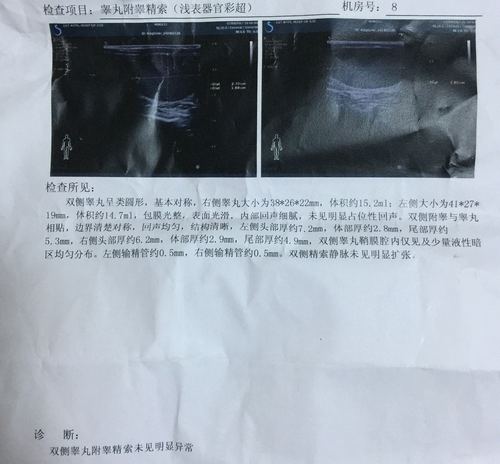 睾丸大小和体积正常吗?