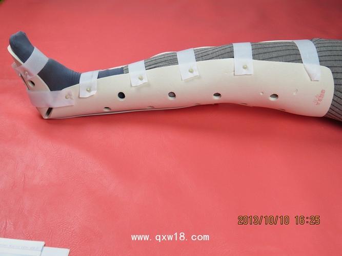 pvc胫腓骨外固定支具下肢骨折医用外固定支具骨折代.