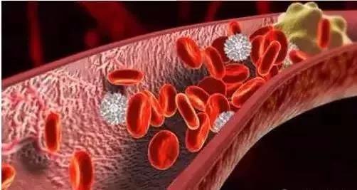 4.微血栓,主要存在于前毛细血管,小动脉,小静脉内,只可见于显微镜下.