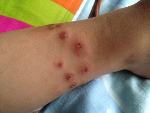 来看看我小儿身上长的是什么?