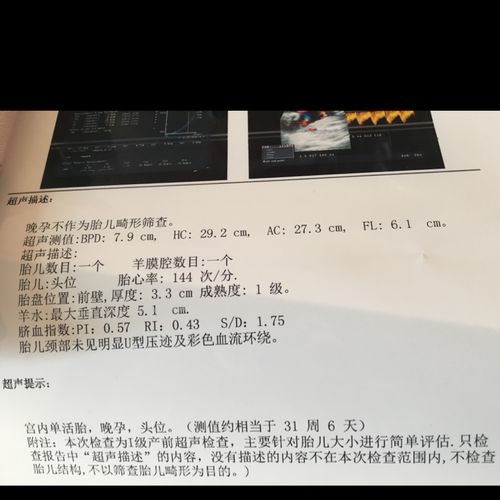 是不是四肢短小啊?