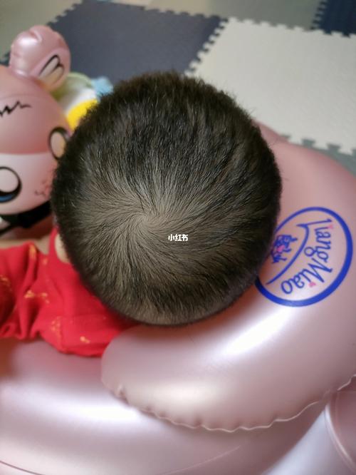 除了前两个月怕呛奶侧身睡,后面就任其发展了,四月剃头时后脑勺儿还突