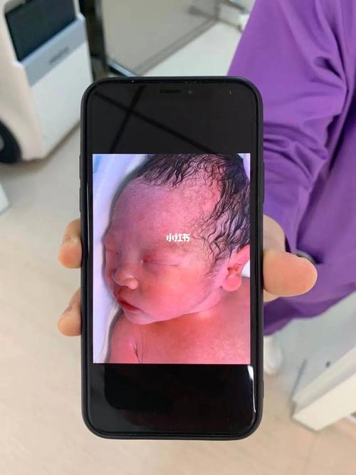 早产35周宝宝的生产经历_早产_宫缩_柚子_产妇_月子_产检_内裤_超市