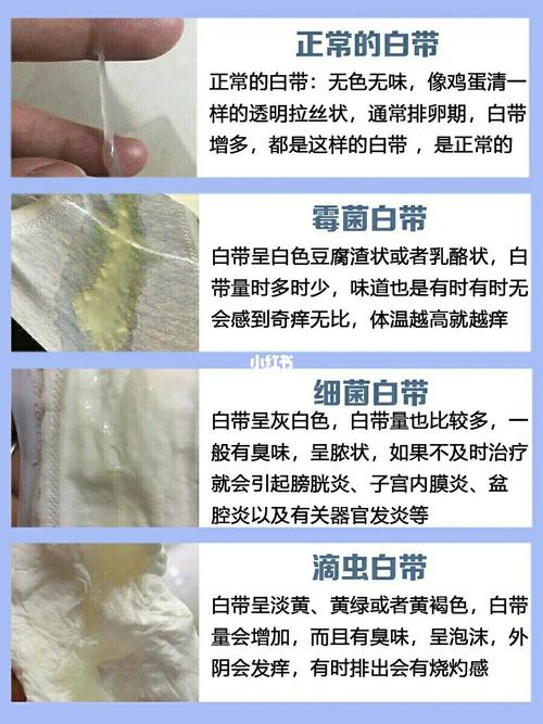 细菌性阴道炎经常反复看这里_炎症_内裤_阴道炎_洗液