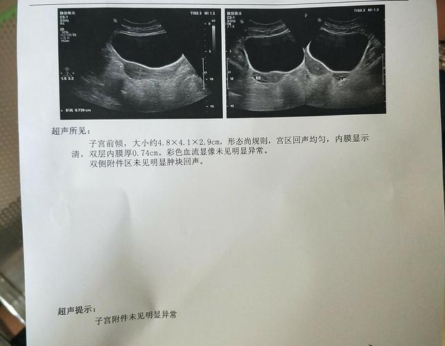 腹部彩超