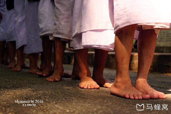 因每日光脚行走,脚都已经变形,还有缅甸的蚊虫在他们的身上留下的印痕