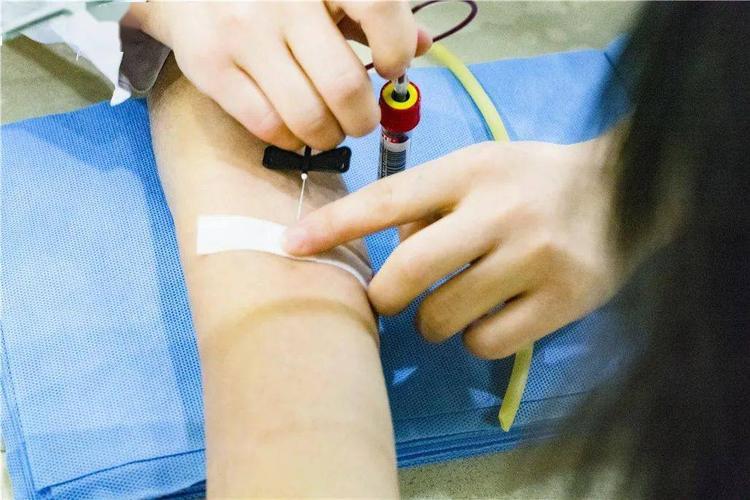 抽血后手臂惊现大面积淤青护士抽血技术太差了