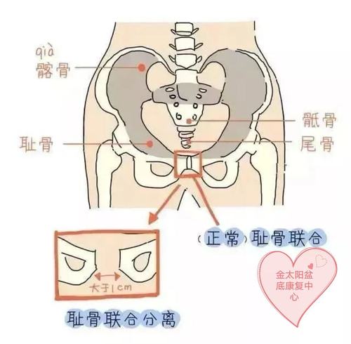 宝妈漏尿,耻骨痛,腰痛等难言之隐金太阳盆底康复中心帮您一站式解决!