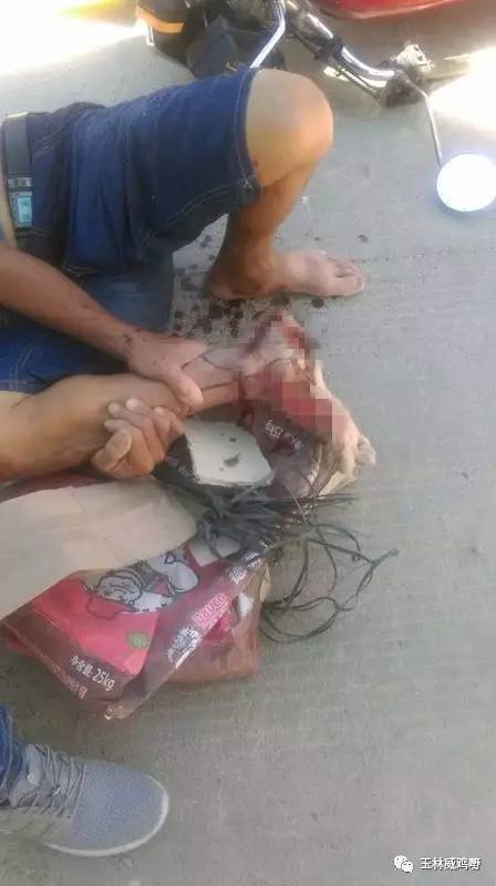 超恐怖的车祸!玉林某男子,脚裸被撞爆,裂开.
