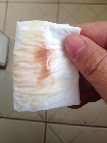 到了来例假的时间没来例假而是白带里面有黑血,已经五