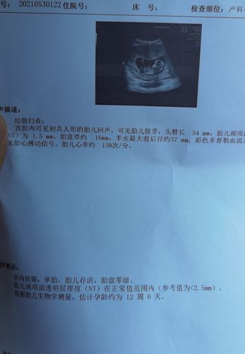 12周nt已过求大神看下是男宝还是女宝