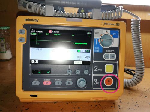 除颤仪的操作流程