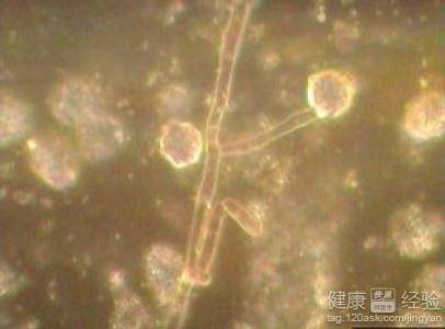 正文  1白假丝酵母菌又称白色念珠菌,是一种常见的真菌,少量也存在于