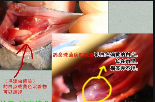 喉头白色霉状物, 葡萄球菌或沙门.