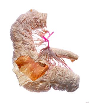 猪盲肠塑化标本