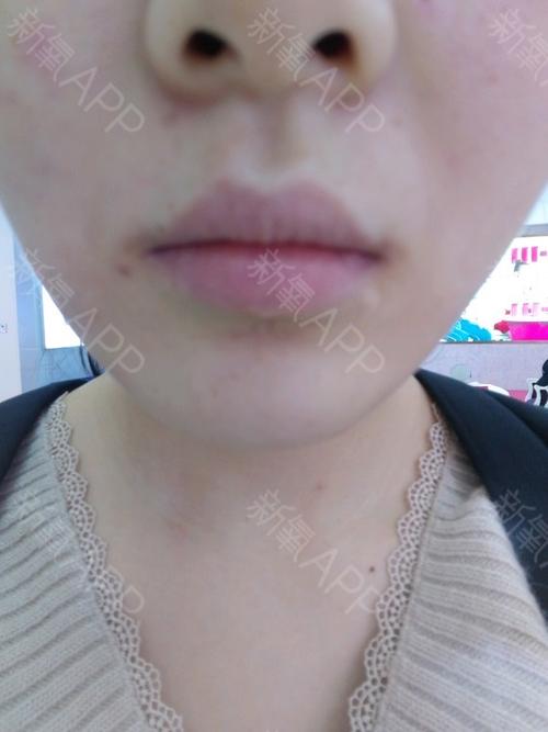 2018年10月21日创建  共1篇日记 【激光脱毛】脱腋毛/唇毛(二选一)