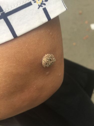 这是什么皮肤病