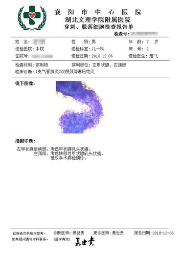幼儿甲状腺癌伴多发淋巴结转移1例 [病例帖]