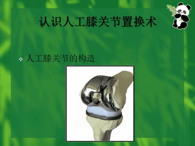 人工膝关节置换术治疗骨性关节炎的护理查房ppt课件