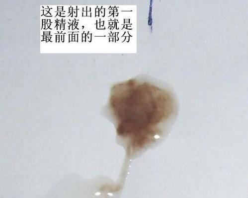 21岁,男,禁欲1个月,昨天手淫发现精液是棕褐色,正常吗