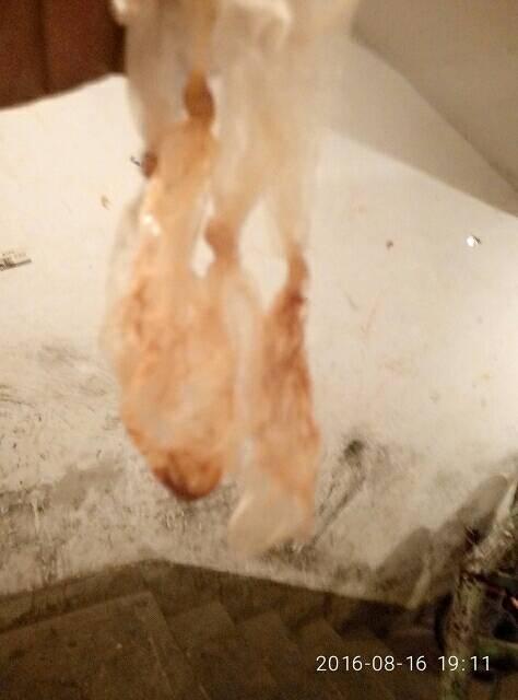 避孕套用完等干了以后发现有血迹是怎么回事?