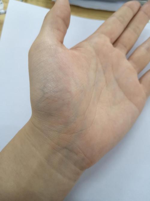 大家的手掌血管会很明显吗