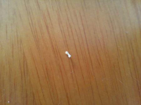 从猫咪肛门处拔出来的,没几分钟就死了.